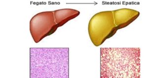 PREVENZIONE DEL DANNO EPATICO